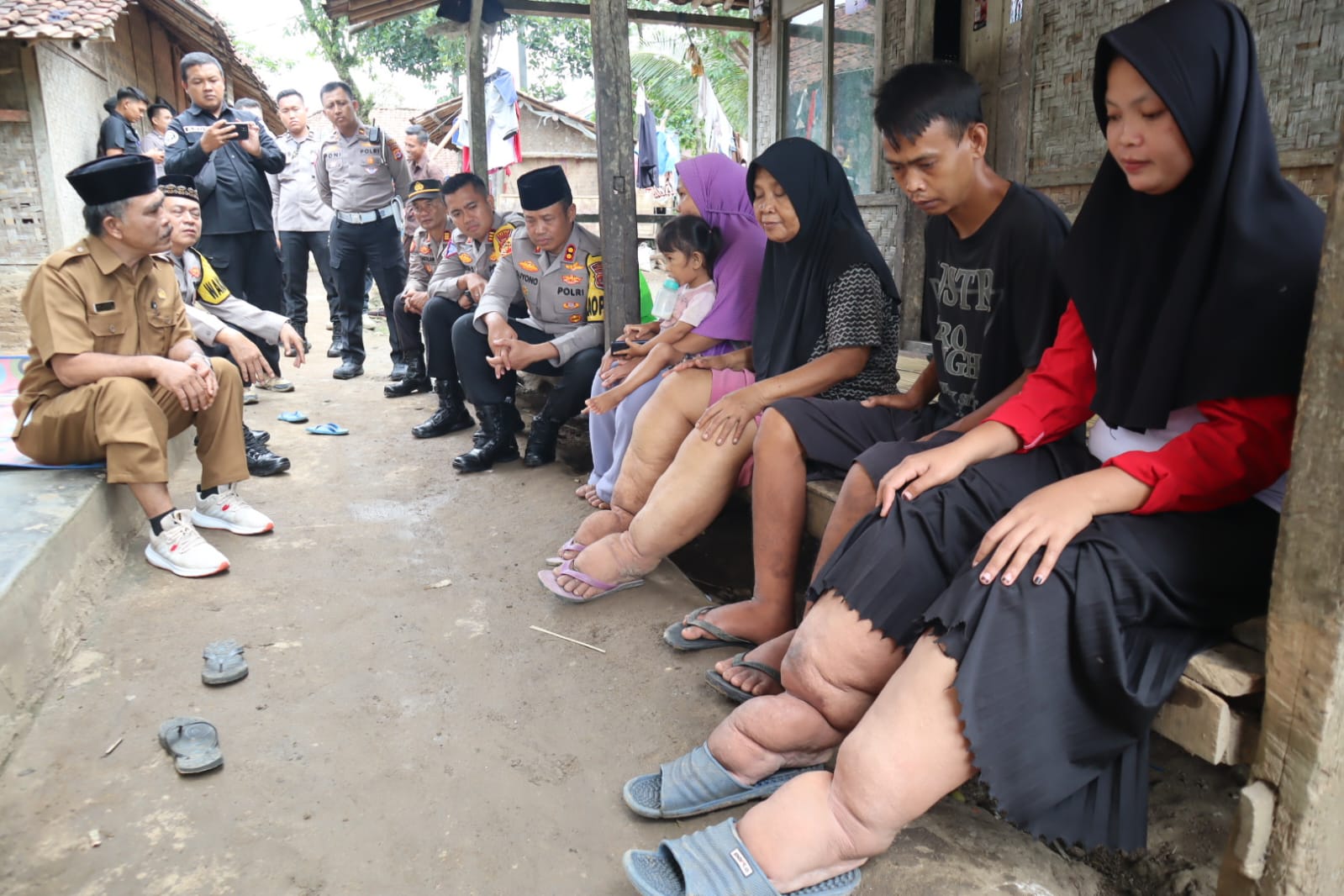 Kapolres Lebak Berikan Batuan Terhadap 5 Orang Keluarga Penderita Kaki Gajah di Desa Jayabaya